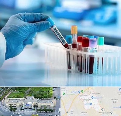 آزمایشگاه خون قبل از ازدواج در نسیم شهر