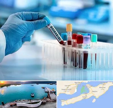 آزمایشگاه خون قبل از ازدواج در قشم
