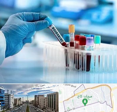 آزمایشگاه خون قبل از ازدواج در سعادت آباد 