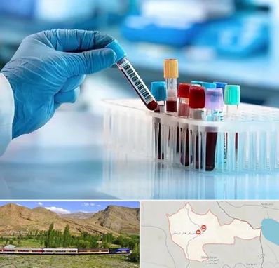 آزمایشگاه خون قبل از ازدواج در خاش