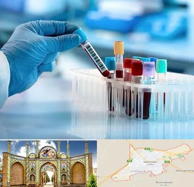 آزمایشگاه خون قبل از ازدواج در سمنان