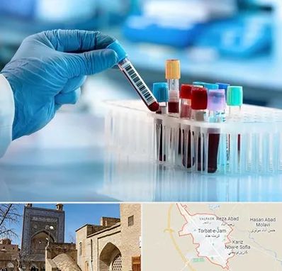 آزمایشگاه خون قبل از ازدواج در تربت جام