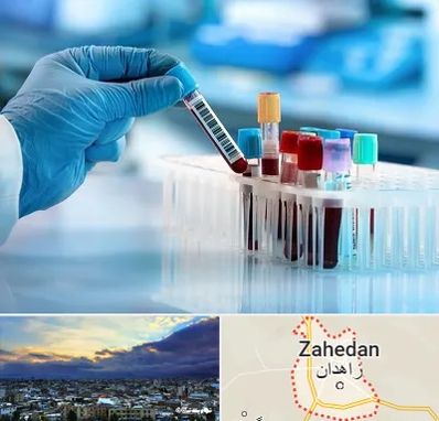 آزمایشگاه خون قبل از ازدواج در زاهدان