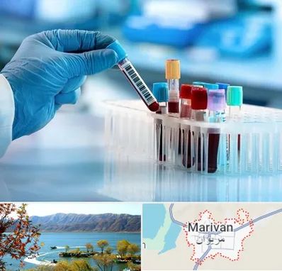 آزمایشگاه خون قبل از ازدواج در مریوان