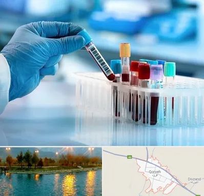آزمایشگاه خون قبل از ازدواج در قروه