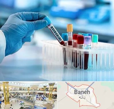 آزمایشگاه خون قبل از ازدواج در بانه