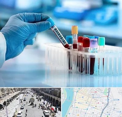 آزمایشگاه خون قبل از ازدواج در نادری اهواز