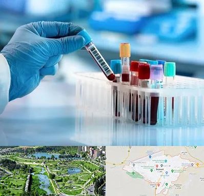 آزمایشگاه خون قبل از ازدواج در بجنورد