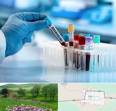 آزمایشگاه خون قبل از ازدواج در سراب