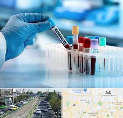 آزمایشگاه خون قبل از ازدواج در جنوب تهران 