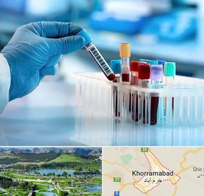 آزمایشگاه خون قبل از ازدواج در خرم آباد