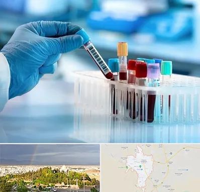 آزمایشگاه خون قبل از ازدواج در تربت حیدریه