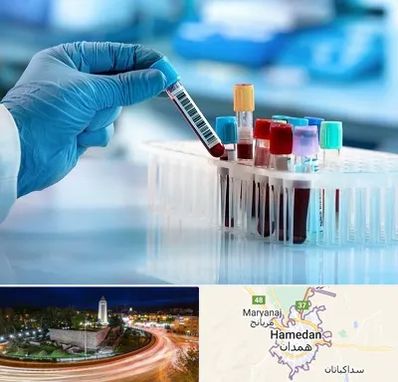 آزمایشگاه خون قبل از ازدواج در همدان