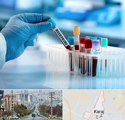 آزمایشگاه خون قبل از ازدواج در گوهردشت کرج 