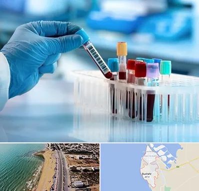 آزمایشگاه خون قبل از ازدواج در بوشهر