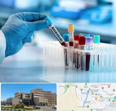آزمایشگاه خون قبل از ازدواج در صیاد شیرازی مشهد