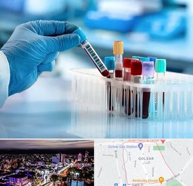 آزمایشگاه خون قبل از ازدواج در گلسار رشت 
