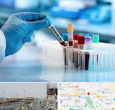 آزمایشگاه خون قبل از ازدواج در بلوار توس مشهد