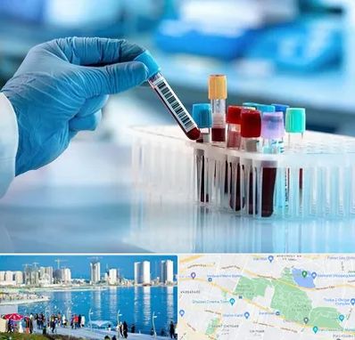 آزمایشگاه خون قبل از ازدواج در چیتگر 