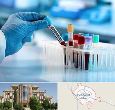 آزمایشگاه خون قبل از ازدواج در دهدشت