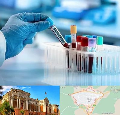 آزمایشگاه خون قبل از ازدواج در خوی