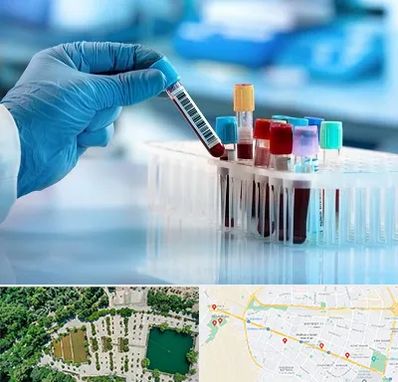 آزمایشگاه خون قبل از ازدواج در وکیل آباد مشهد
