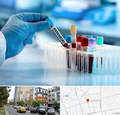 آزمایشگاه خون قبل از ازدواج در هفده شهریور تبریز