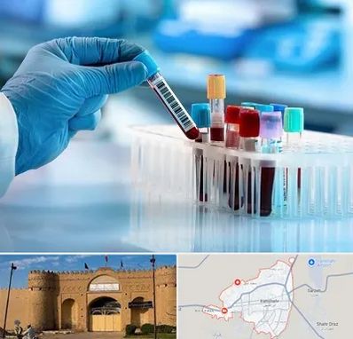 آزمایشگاه خون قبل از ازدواج در ایرانشهر