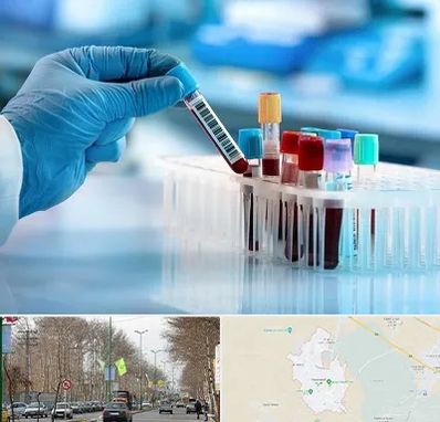 آزمایشگاه خون قبل از ازدواج در نظرآباد کرج