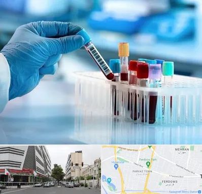 آزمایشگاه خون قبل از ازدواج در بلوار فردوس 