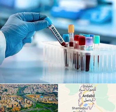 آزمایشگاه خون قبل از ازدواج در اردبیل