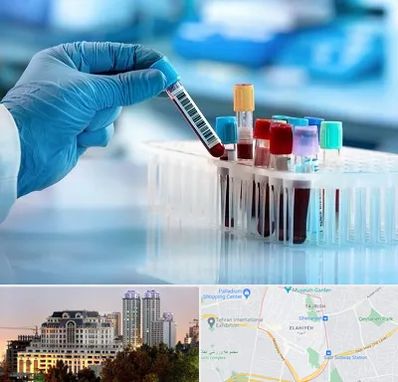 آزمایشگاه خون قبل از ازدواج در فرشته 