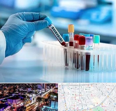 آزمایشگاه خون قبل از ازدواج در منظریه رشت