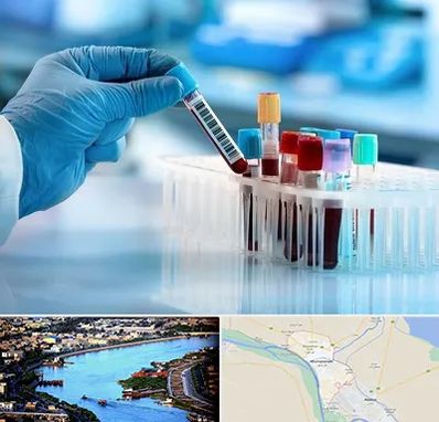 آزمایشگاه خون قبل از ازدواج در خرمشهر