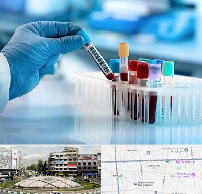 آزمایشگاه خون قبل از ازدواج در مرکز تهران