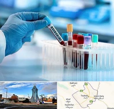 آزمایشگاه خون قبل از ازدواج در تایباد