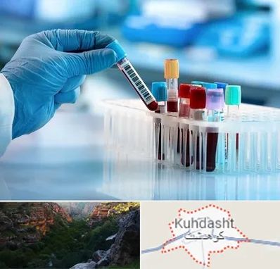 آزمایشگاه خون قبل از ازدواج در کوهدشت