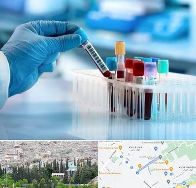 آزمایشگاه خون قبل از ازدواج در محلاتی شیراز