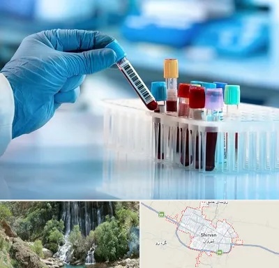 آزمایشگاه خون قبل از ازدواج در شیروان