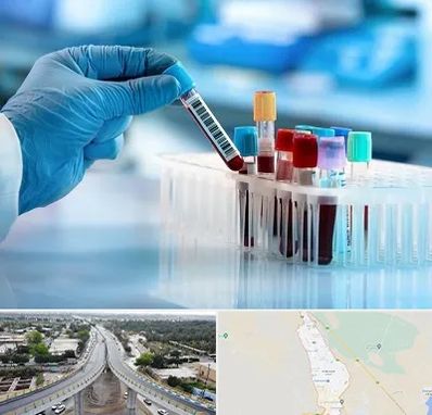 آزمایشگاه خون قبل از ازدواج در اندیمشک