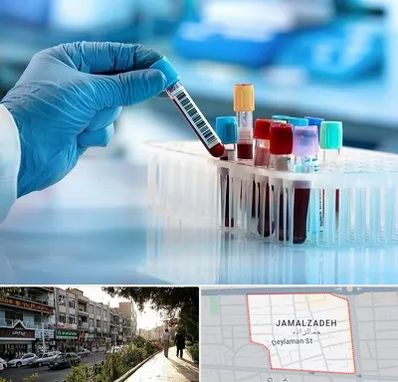 آزمایشگاه خون قبل از ازدواج در خیابان جمالزاده
