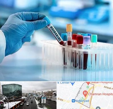 آزمایشگاه خون قبل از ازدواج در اقدسیه 