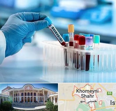 آزمایشگاه خون قبل از ازدواج در خمینی شهر