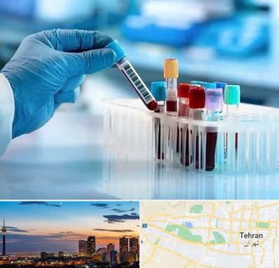 آزمایشگاه خون قبل از ازدواج در غرب تهران 
