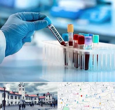 آزمایشگاه خون قبل از ازدواج در میدان شهرداری رشت