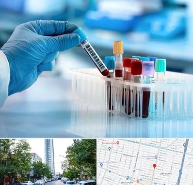 آزمایشگاه خون قبل از ازدواج در امامت مشهد