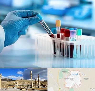 آزمایشگاه خون قبل از ازدواج در مرودشت