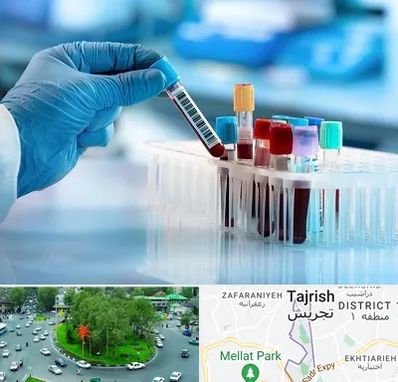 آزمایشگاه خون قبل از ازدواج در تجریش 