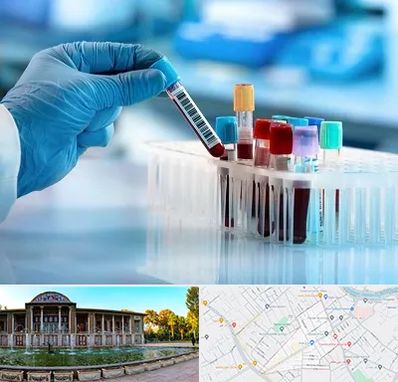 آزمایشگاه خون قبل از ازدواج در عفیف آباد شیراز