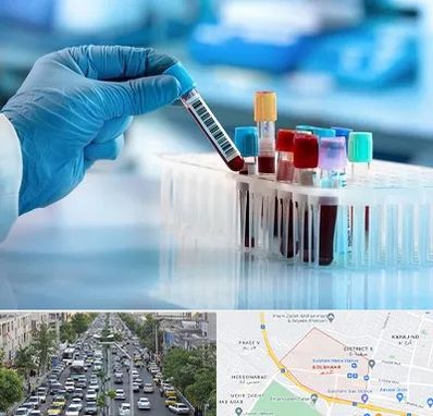 آزمایشگاه خون قبل از ازدواج در گلشهر کرج